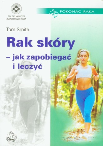 Rak skóry - jak zapobiegać i leczyć Rak skóry - jak zapobiegać i leczyć