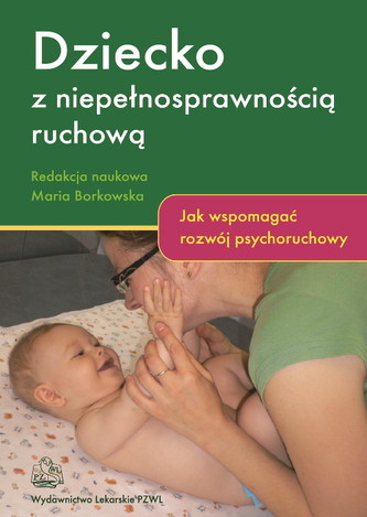 Dziecko z niepełnosprawnością ruchową. Jak wspomagać rozwój psychoruchowy