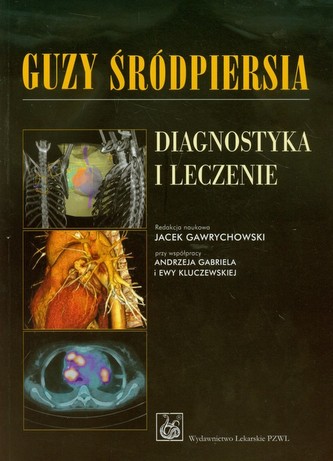Guzy śródpiersia Diagnostyka i leczenie Guzy śródpiersia Diagnostyka i leczenie