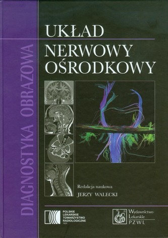 Diagnostyka obrazowa Układ nerwowy ośrodkowy Diagnostyka obrazowa Układ nerwowy ośrodkowy