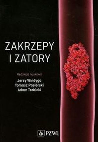 Zakrzepy i zatory Zakrzepy i zatory