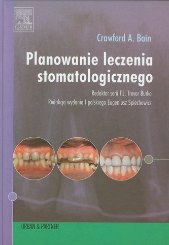 Planowanie leczenia stomatologicznego