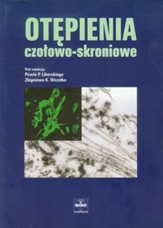 Otępienia czołowo skroniowe