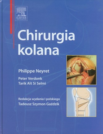 Chirurgia kolana Chirurgia kolana