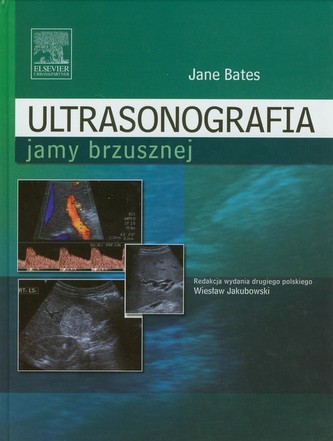 Ultrasonografia jamy brzusznej Ultrasonografia jamy brzusznej