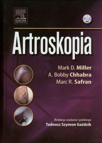 Artroskopia Artroskopia