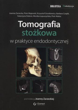 Tomografia stożkowa w praktyce endodontycznej Tomografia stożkowa w praktyce endodontycznej