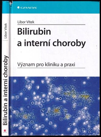 Bilirubin a interní choroby