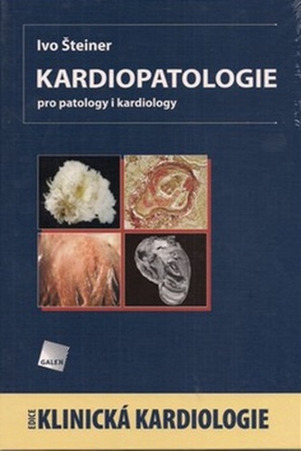 Kardiopatologie : pro patology i kardiology (Ivo Šteiner, 2010)