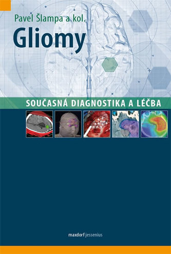Gliomy - současná diagnostika a léčba