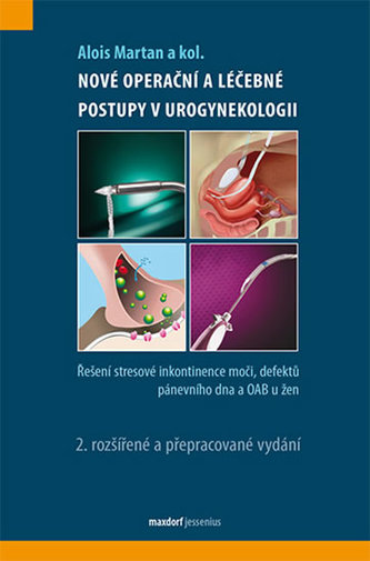 Nové operační postupy v urogynekologii - Řešení stresové inkontinence moči a defektů pánevního dna u žen