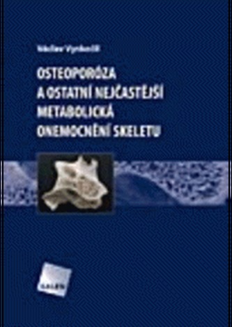 Osteoporóza a ostatní nejčastější metabolická onemocnění skeletu