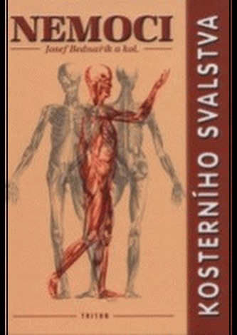 Nemoci kosterního svalstva (Josef Bednařík, 2001)