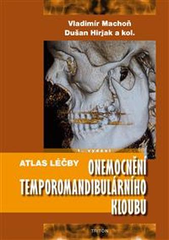 Atlas léčby onemocnění temporomandibulárního kloubu