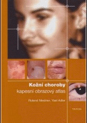 Kožní choroby: kapesní obrazový atlas