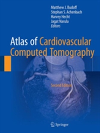 Atlas of Cardiovascular Computed Tomography