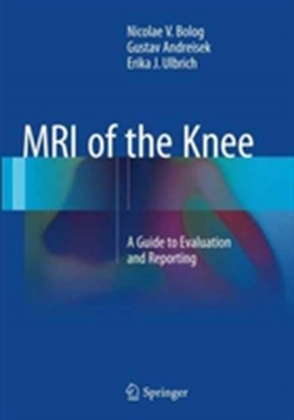 MRI of the Knee MRI of the Knee