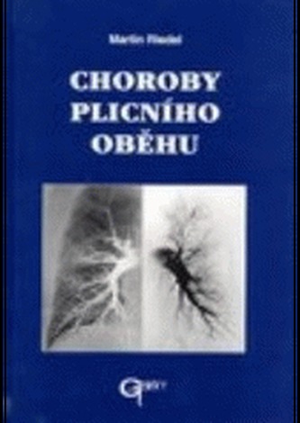 Choroby plicního oběhu (Martin Riedel, 2000)