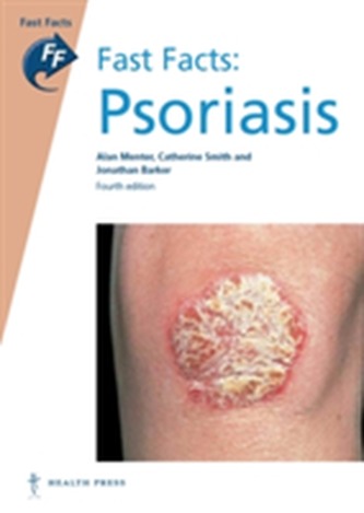 Fast Facts: Psoriasis Fast Facts: Psoriasis