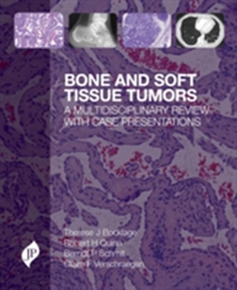 Bone and Soft Tissue Tumors Bone and Soft Tissue Tumors