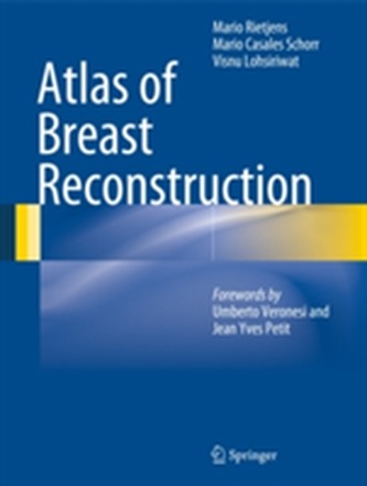 Atlas of Breast Reconstruction
