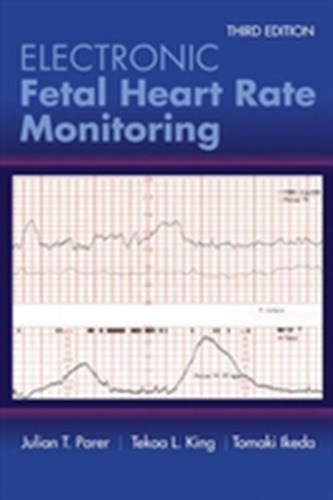 Electronic Fetal Heart Rate Monitoring