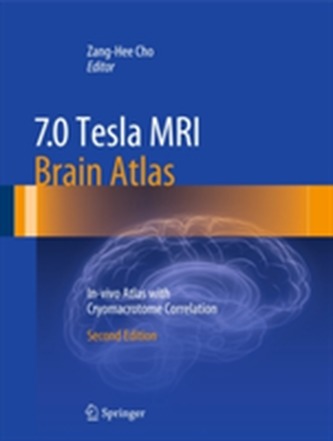 7.0 Tesla MRI Brain Atlas