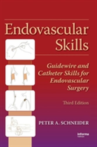 Endovascular Skills