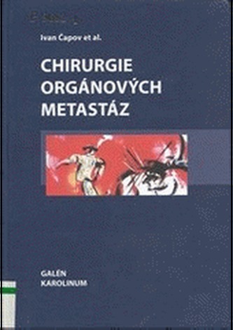 Chirurgie orgánových metastáz