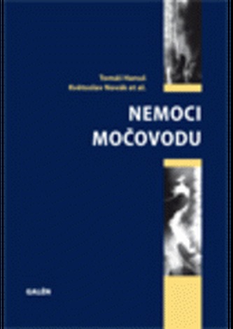 Nemoci močovodu