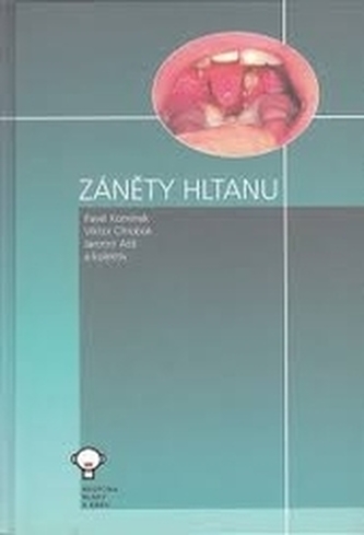 Záněty hltanu Záněty hltanu