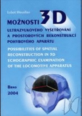 Možnosti 3D ultrazvukového vyšetřování a prostorových rekonstrukcí pohybového aparátu  