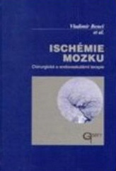 Ischémie mozku