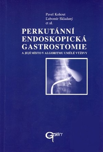 Perkutánní endoskopická gastrostomie