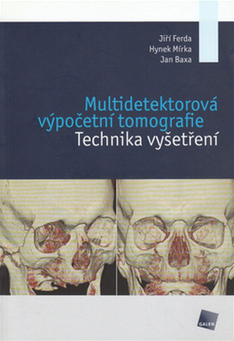 Multidetektorová výpočetní tomografie