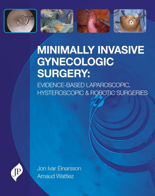 Minimally Invasive Gynecologic Surgery EvidenceBased Laparoscopic