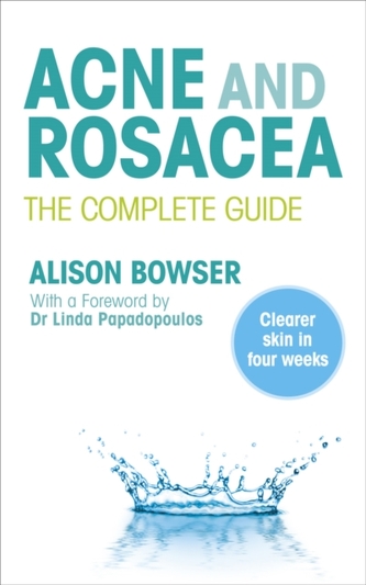 Acne and Rosacea Acne and Rosacea