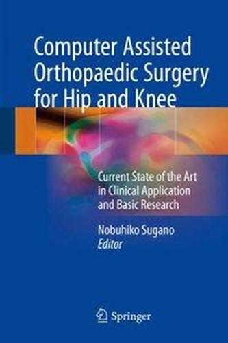 Computer Assisted Orthopaedic Surgery for Hip and Knee