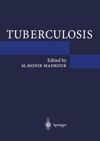Tuberculosis