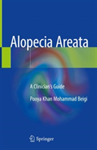 Alopecia Areata Alopecia Areata