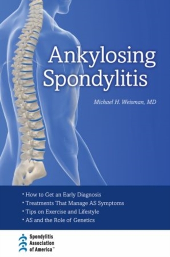 Ankylosing Spondylitis