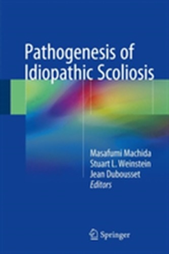 Pathogenesis of Idiopathic Scoliosis