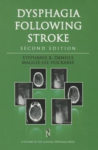 Dysphagia Following Stroke