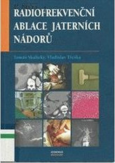 Radiofrekvenční ablace jaterních nádorů