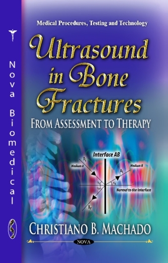 Ultrasound in Bone Fractures