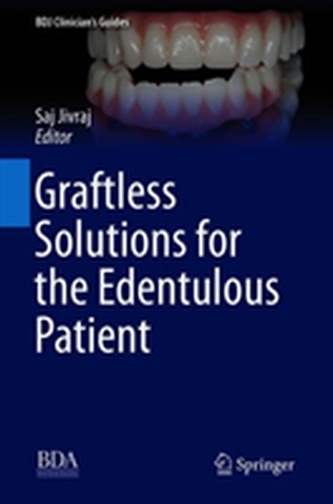 Graftless Solutions for the Edentulous Patient Graftless Solutions for the Edentulous Patient