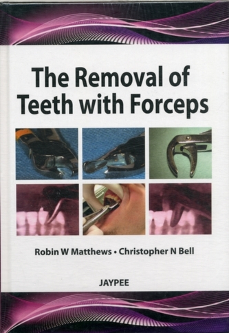The Removal of Teeth with Forceps The Removal of Teeth with Forceps