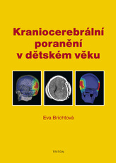 Kraniocerebrální poranění v dětském věku