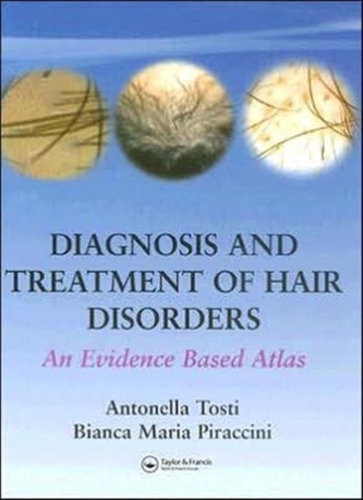 Diagnosis and Treatment of Hair Disorders