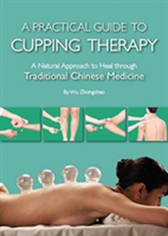 Practical Guide to Cupping Therapy